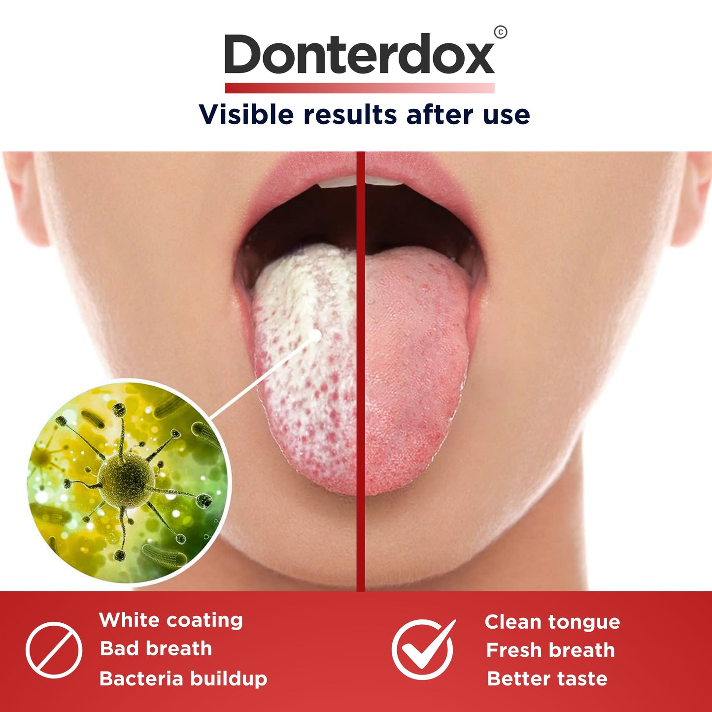 Tongue Scraper - ที่ขูดลิ้นสแตนเลสทรง U-Shape