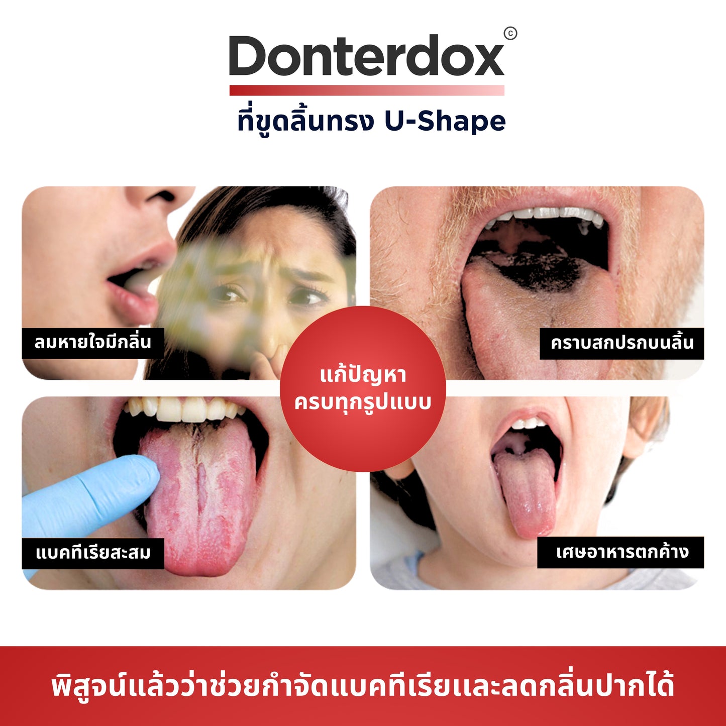 Tongue Scraper - ที่ขูดลิ้นสแตนเลสทรง U-Shape