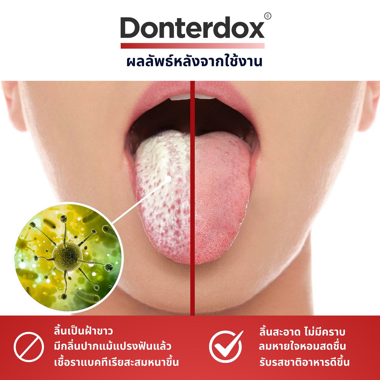 Tongue Scraper - ที่ขูดลิ้นสแตนเลสทรง U-Shape